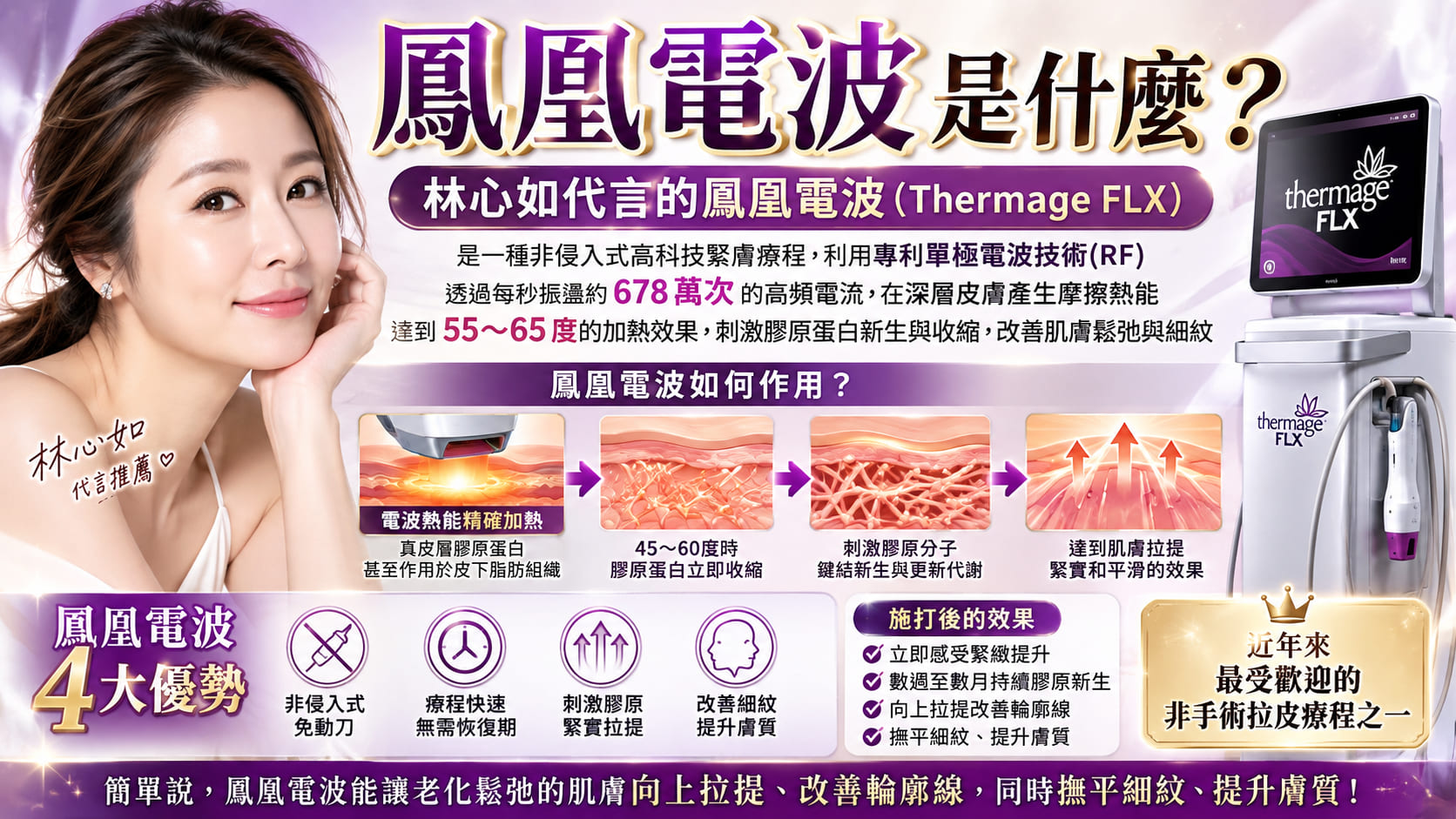 鳳凰電波拉提是什麼?Thermage FLX原理、效果、施打流程與注意事項